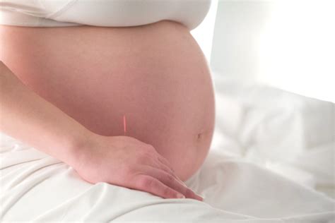 How Acupuncture Can Aid Mama's Physical Recovery After Birth
